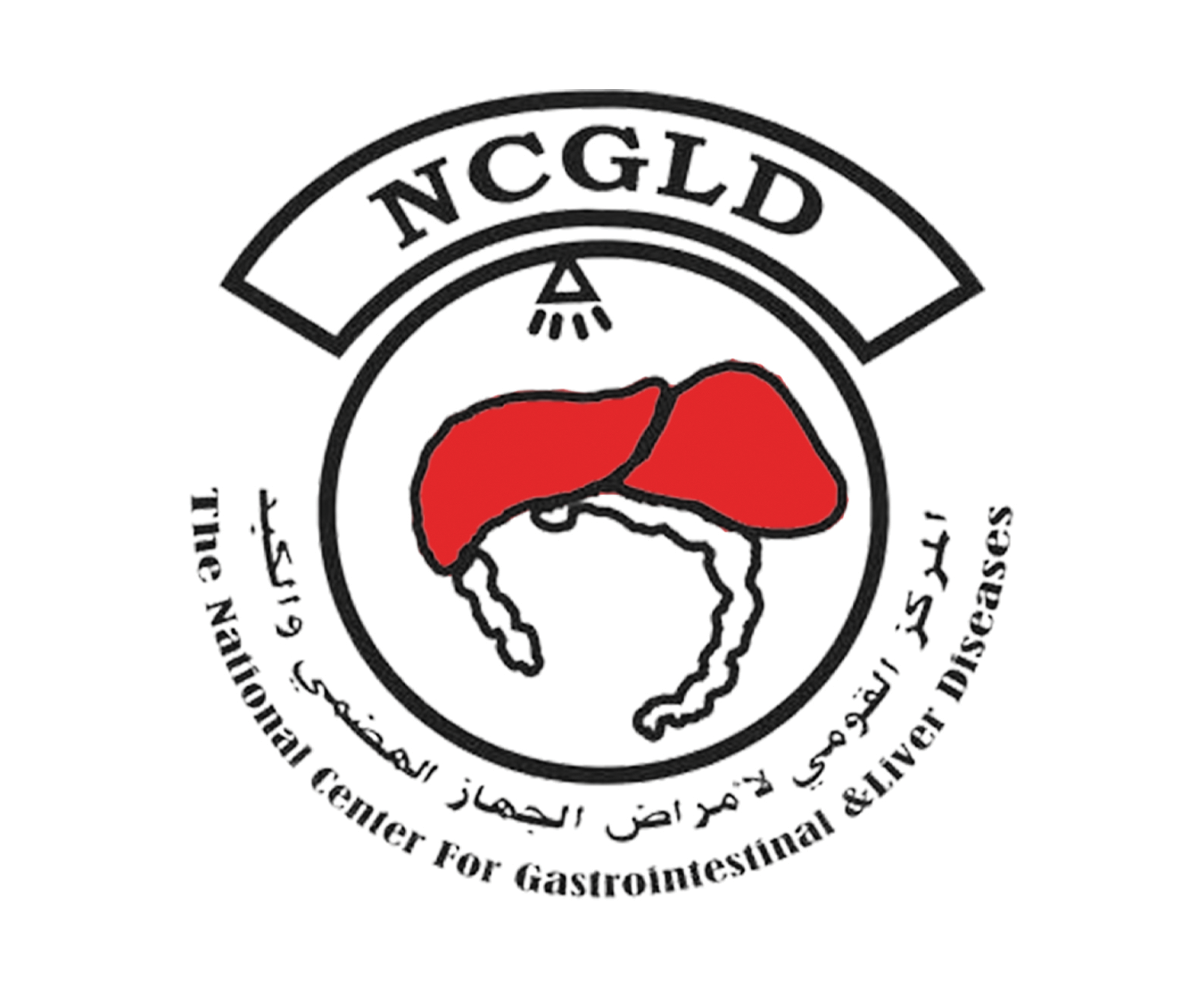 NCGLD